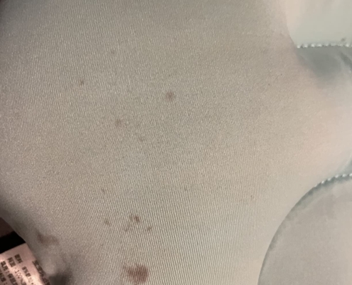 Mold growth visible on the cushion of an infant bathtub, highlighting poor air circulation and dampness issues.