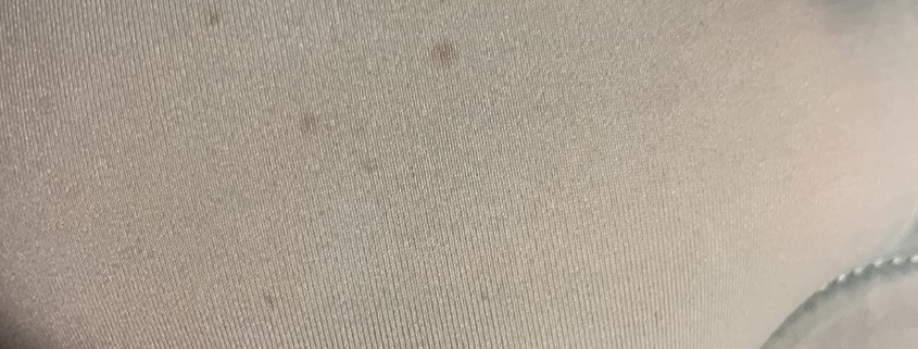 Mold growth visible on the cushion of an infant bathtub, highlighting poor air circulation and dampness issues.
